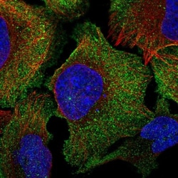 C16orf74 Antibody, Novus Biologicals 0.1mL; Unlabeled:Antibodies, Polyclonal